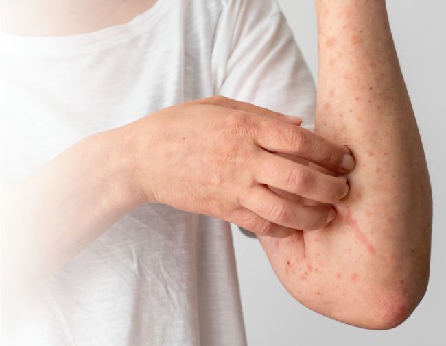Васкулит — когда сосуды дают сигнал бедствия